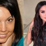 Оксана Самойлова фото до и после пластики