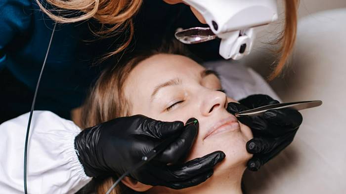 Обучение электроэпиляции