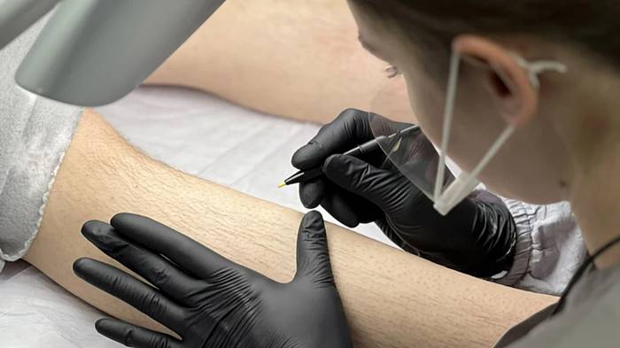 Курсы электроэпиляции